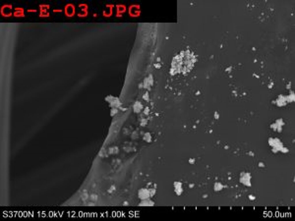 SEM of albicans treated with innovosil antimicrobial silver