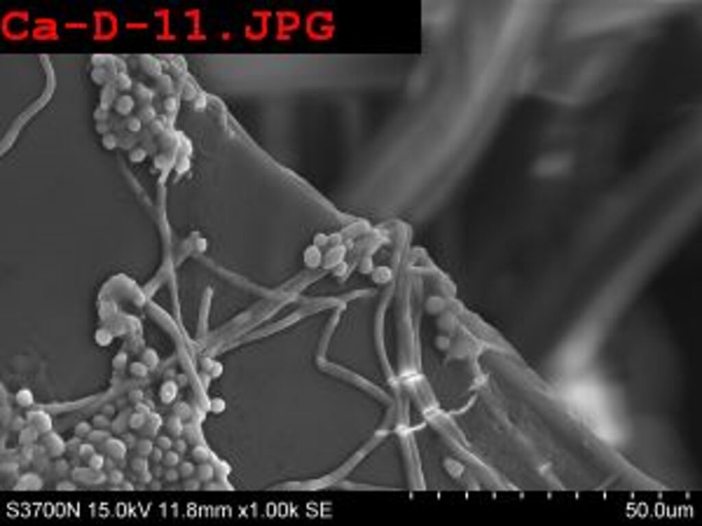 SEM of albicans untreated before antimicrobial silver